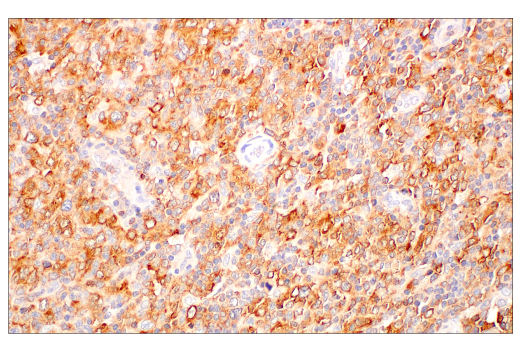 Immunohistochemistry Image 1: c-Rel (E8Z5Y) XP<sup>®</sup> Rabbit mAb (BSA and Azide Free)