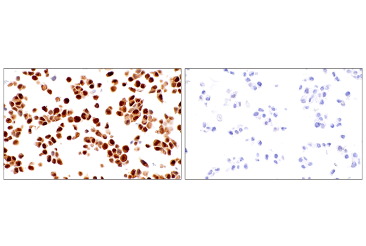 Immunohistochemistry Image 6: CDK2 (E8J9T) XP<sup>®</sup> Rabbit mAb (BSA and Azide Free)