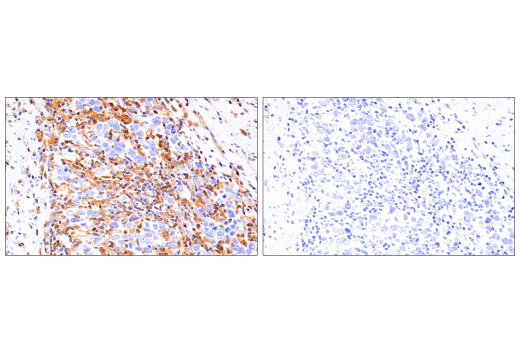 Immunohistochemistry Image 5: RIP3 (E7A7F) XP<sup>®</sup> Rabbit mAb