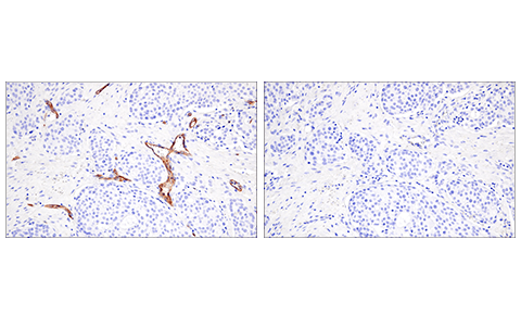 Immunohistochemistry Image 4: CD200 (E5I9V) XP<sup>®</sup> Rabbit mAb