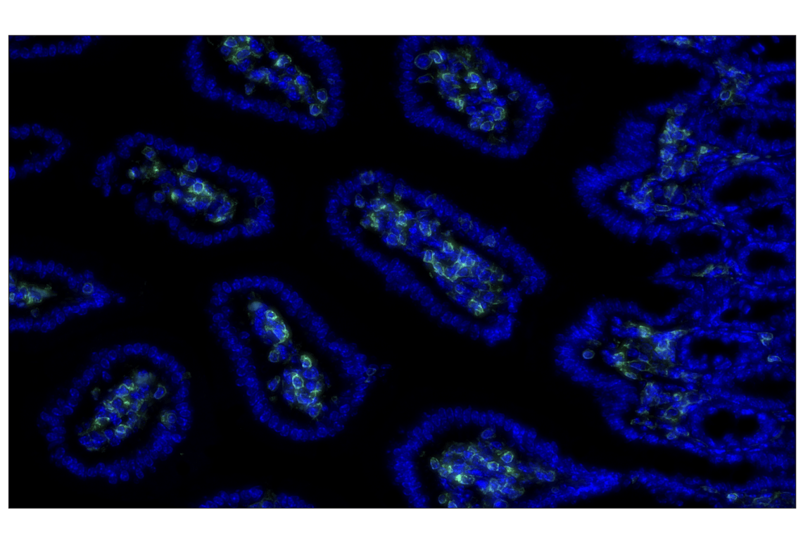Immunohistochemistry Image 1: CD45 (D3F8Q) Rabbit mAb (Alexa Fluor<sup>®</sup> 488 Conjugate)