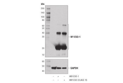 Western Blotting Image 2: NY-ESO-1 (D1Q2U) Rabbit mAb