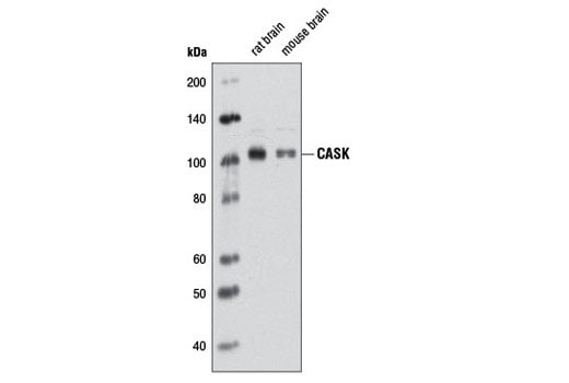 Western Blotting Image 1: CASK (D38F6) Rabbit mAb