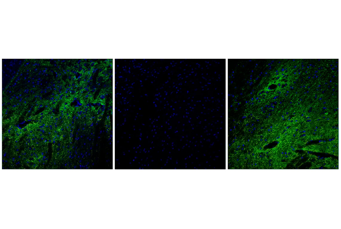 Immunofluorescence Image 1: Phospho-Synapsin-1 (Ser9) (E3D2X) Rabbit mAb