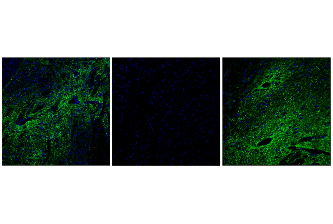 Immunofluorescence Image 1: Phospho-Synapsin-1 (Ser9) (E3D2X) Rabbit mAb