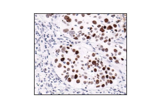Immunohistochemistry Image 1: Phospho-Histone H2A.X (Ser139) (20E3) Rabbit mAb