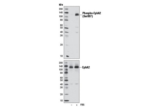 Western Blotting Image 1: Phospho-EphA2 (Ser897) (D9A1) Rabbit mAb