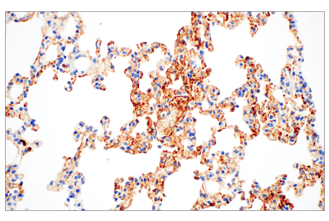 Immunohistochemistry Image 3: C1QB (E3U6X) Rabbit mAb (BSA and Azide Free)