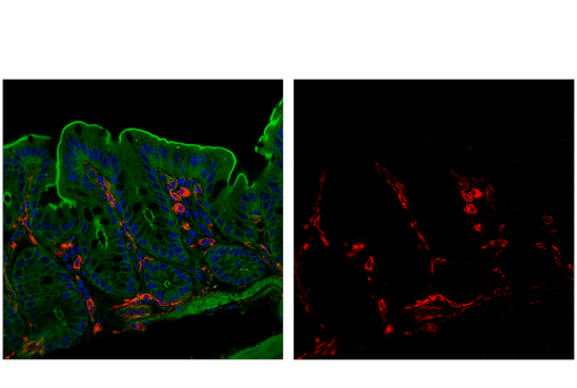 Immunofluorescence Image 1: VISTA (D5L5T) XP<sup>®</sup> Rabbit mAb (Alexa Fluor<sup>®</sup> 647 Conjugate)