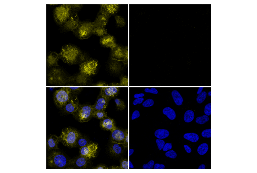 Immunofluorescence Image 1: Iba1/AIF-1 (E4O4W) XP<sup>®</sup> Rabbit mAb (Alexa Fluor<sup>®</sup> 555 Conjugate)