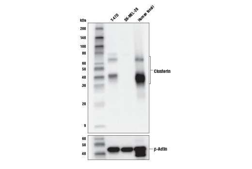 Western Blotting Image 1: Clusterin (D7N2K) XP<sup>®</sup> Rabbit mAb