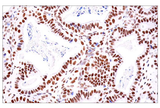 Immunohistochemistry Image 5: ATRX (E5X7O) Rabbit mAb (BSA and Azide Free)