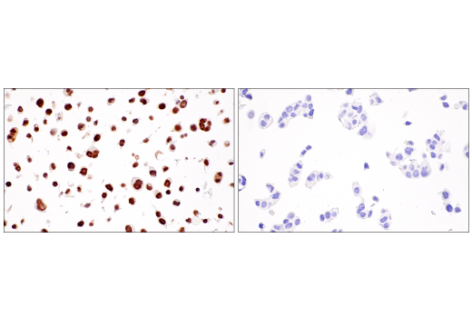 Immunohistochemistry Image 9: RUNX3/AML2 (E8D5W) XP<sup>®</sup> Rabbit mAb