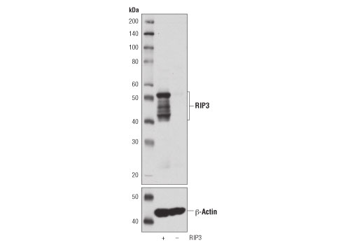 undefined Image 24: Mouse Reactive PANoptosis Antibody Sampler Kit