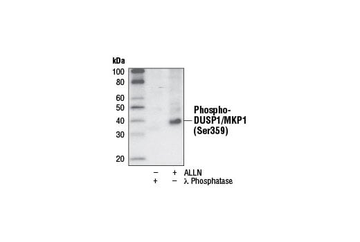 Western Blotting Image 1: Phospho-DUSP1/MKP1 (Ser359) (125E2) Rabbit mAb