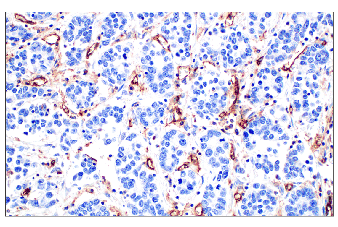 Immunohistochemistry Image 8: CD31 (PECAM-1) (F8M3S) Rabbit mAb (BSA and Azide Free)