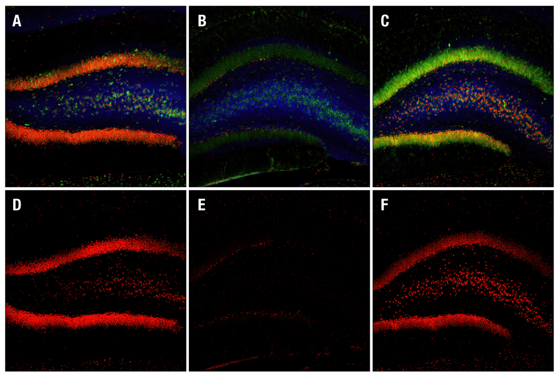undefined Image 75: Cannabinoid Receptor 1 Downstream Signaling Antibody Sampler Kit