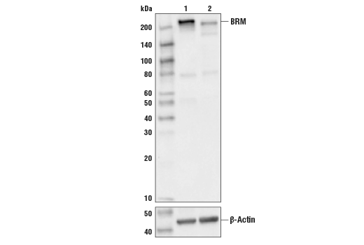 undefined Image 1: BAF Complex IHC Antibody Sampler Kit