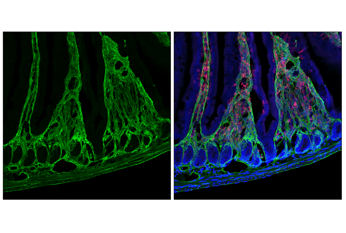 Immunofluorescence Image 2: COL6A1 (E9U3B) Rabbit mAb (BSA and Azide Free)