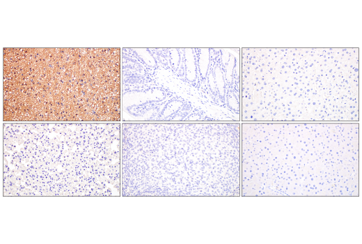 Immunohistochemistry Image 1: UCP1 (E9Z2V) XP<sup>®</sup> Rabbit mAb (BSA and Azide Free)