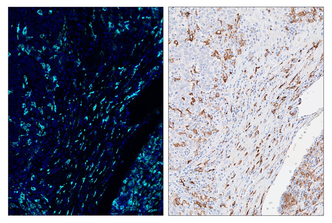 Immunohistochemistry Image 6: CD163 (D6U1J) & CO-0022-488 SignalStar<sup>™</sup> Oligo-Antibody Pair