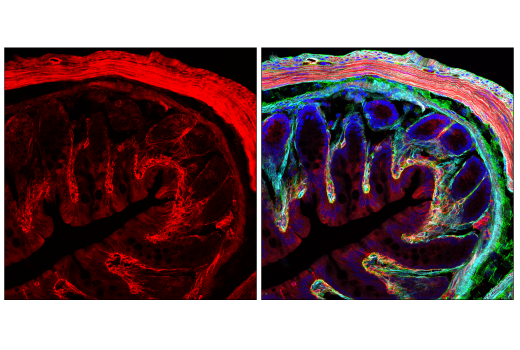 Immunofluorescence Image 1: Myosin IIa (E7Y9O) Rabbit mAb