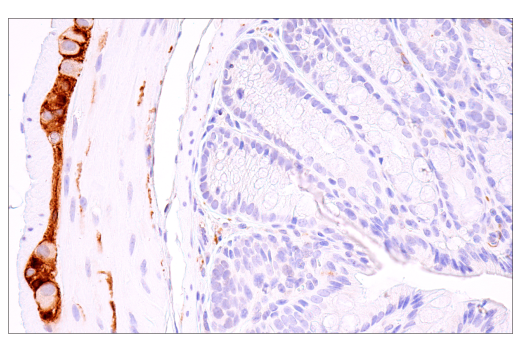 Immunohistochemistry Image 2: S100B (E9F2I) Rabbit mAb (BSA and Azide Free)