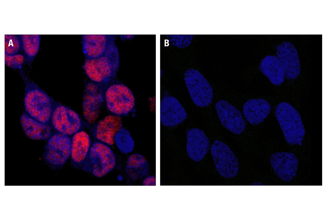 undefined Image 17: PhosphoPlus<sup>®</sup> CREB (Ser133) Antibody Duet