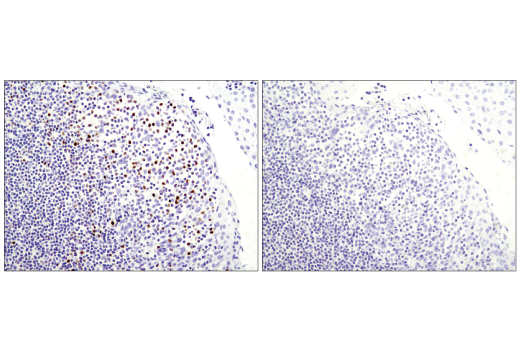 Immunohistochemistry Image 3: T-bet/TBX21 (D6N8B) XP<sup>®</sup> Rabbit mAb (BSA and Azide Free)