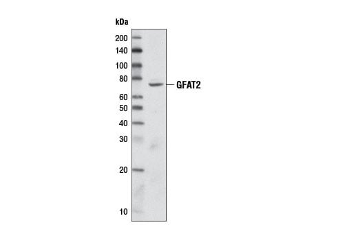 undefined Image 6: Glutamine Metabolism Antibody Sampler Kit