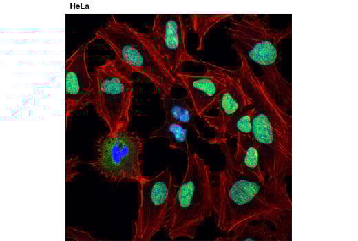 Immunofluorescence Image 1: DDX5 (D15E10) XP<sup>®</sup> Rabbit mAb