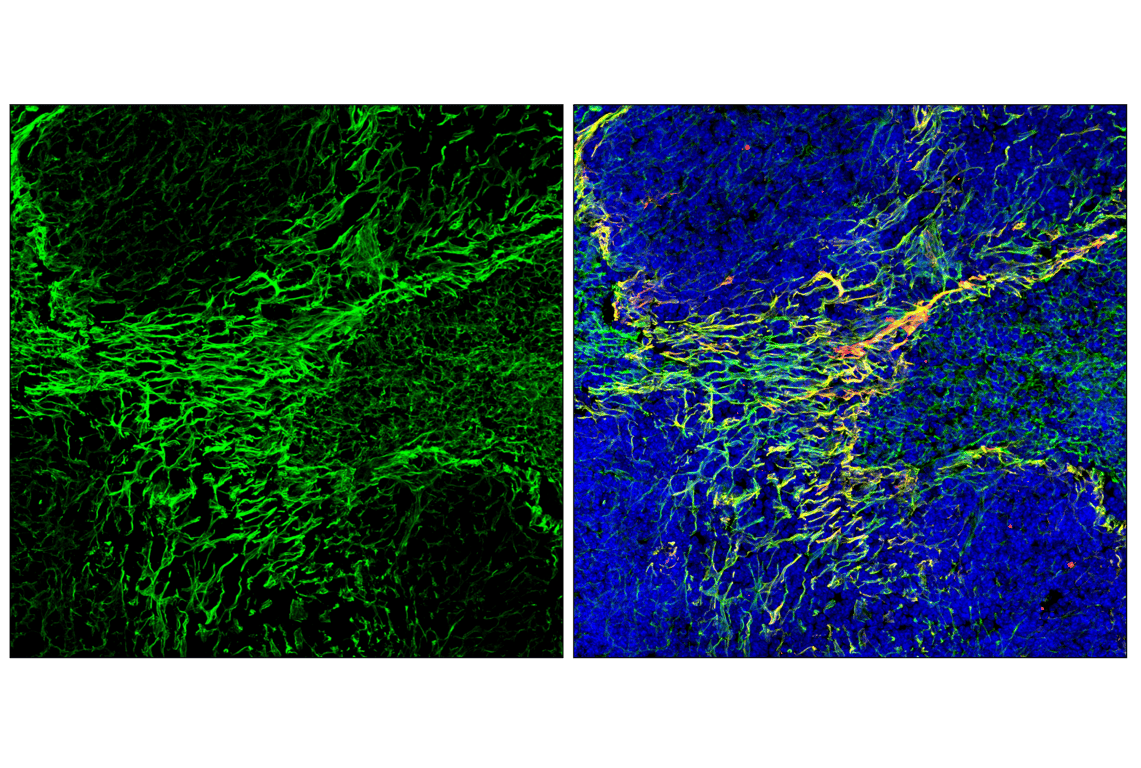 Immunofluorescence Image 3: Caldesmon-1 (D5C8D) XP<sup>®</sup> Rabbit mAb
