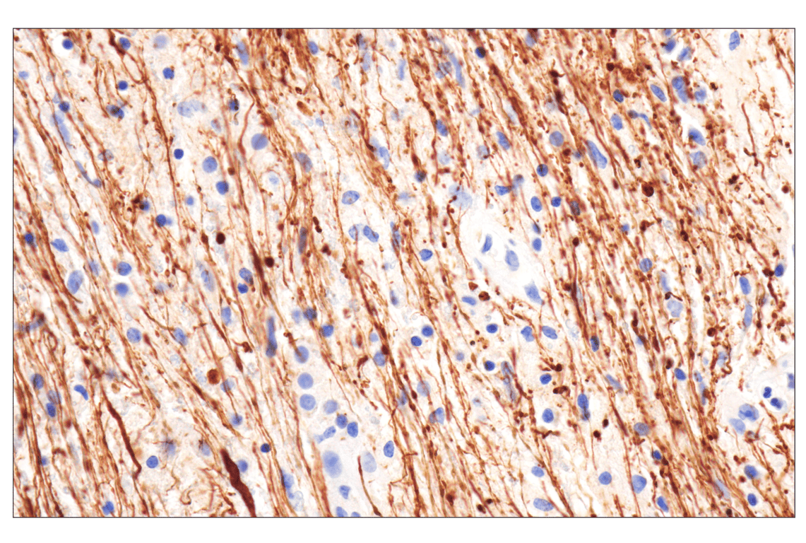 Immunohistochemistry Image 1: Neurofilament-M (E7L2T) Rabbit mAb