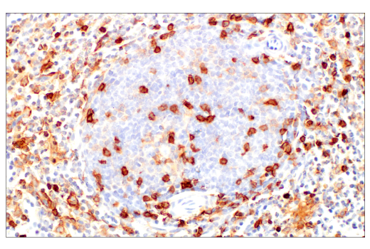 Immunohistochemistry Image 8: CD4 (EP204) Rabbit mAb