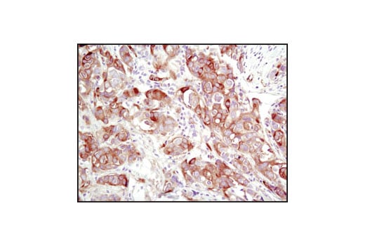 Immunohistochemistry Image 1: TGM2 (D11A6) XP<sup>®</sup> Rabbit mAb