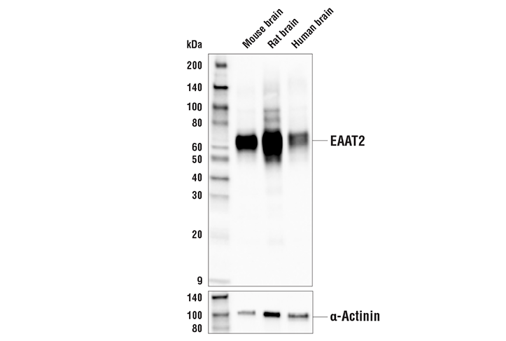Astrocyte Markers Antibody Sampler Kit: Image 1