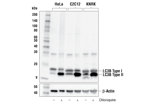 Western Blotting Image 2: LC3B (E7X4S) XP<sup>®</sup> Rabbit mAb