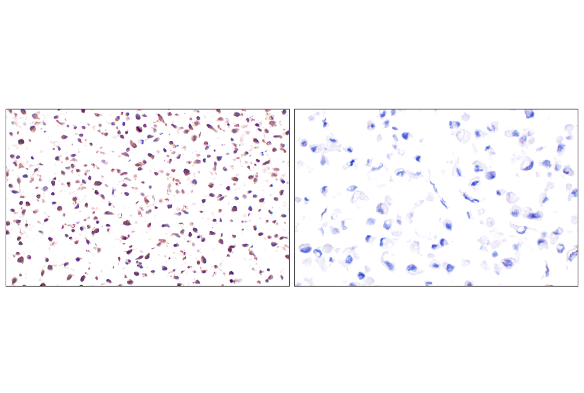 Immunohistochemistry Image 12: Galectin-8/LGALS8 (F9O3T) Rabbit mAb