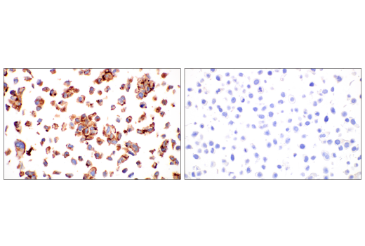 Immunohistochemistry Image 2: CYR61 (E5W3H) Rabbit mAb