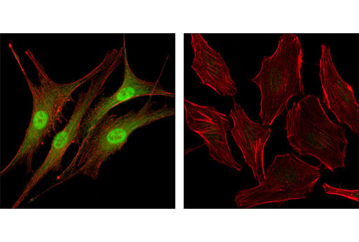 Immunofluorescence Image 1: Livin (D61D1) XP<sup>®</sup> Rabbit mAb