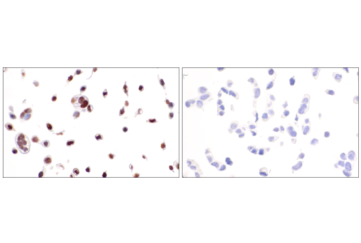 Immunohistochemistry Image 4: p40 (BC28) Mouse mAb