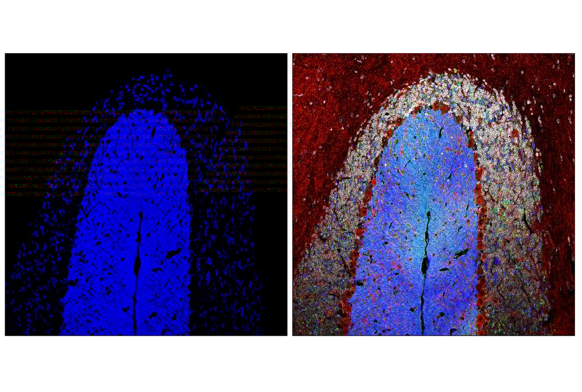 Immunofluorescence Image 2: Bassoon (D63B6) Rabbit mAb (Alexa Fluor<sup>®</sup> 647 Conjugate)