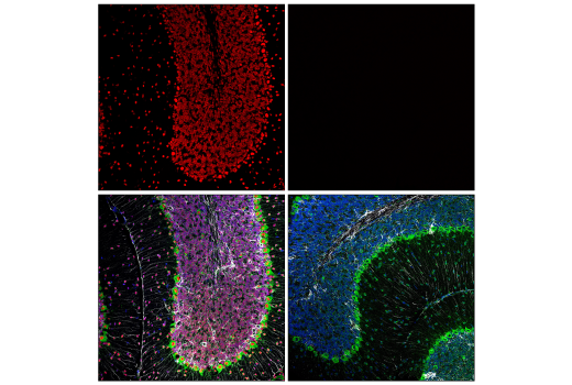 Immunofluorescence Image 1: MeCP2 (D4F3) XP<sup>®</sup> Rabbit mAb (BSA and Azide Free)