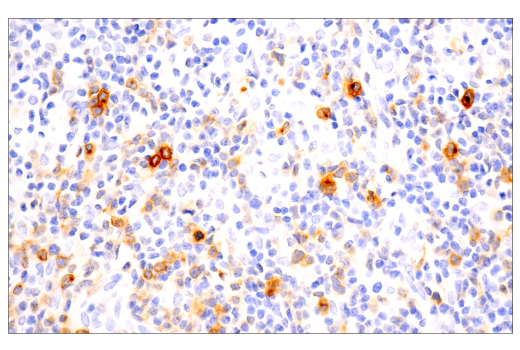 Immunohistochemistry Image 1: TNFRSF8/CD30 (E7E4D) XP<sup>®</sup> Rabbit mAb