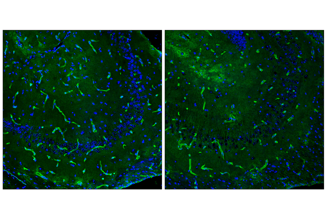 Immunofluorescence Image 4: AQP4 (D1F8E) XP<sup>®</sup> Rabbit mAb