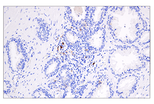 undefined Image 40: Human Reactive PANoptosis Antibody Sampler Kit