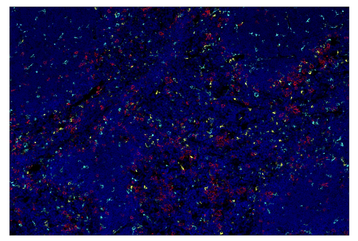 Immunohistochemistry Image 1: CD68 (E3O7V) & CO-0096-488 SignalStar<sup>™</sup> Oligo-Antibody Pair