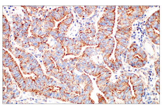 Immunohistochemistry Image 6: TFAM (D5C8) Rabbit mAb