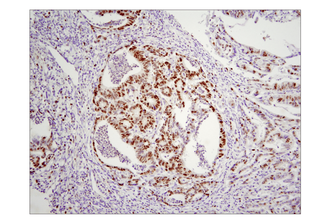 Immunohistochemistry Image 2: Ki-67 (8D5) Mouse mAb