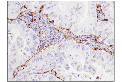 Immunohistochemistry Image 2: CD14 (D7A2T) Rabbit mAb (IHC Formulated)